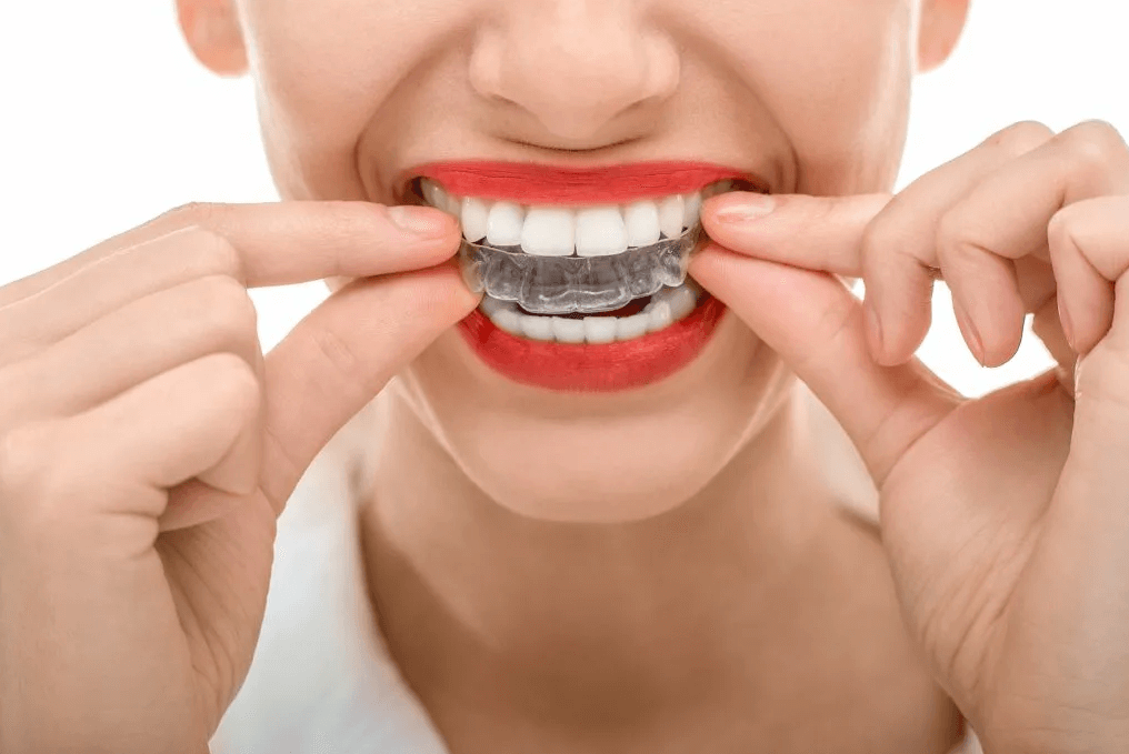 Как ухаживать за зубами при ношении элайнеров?